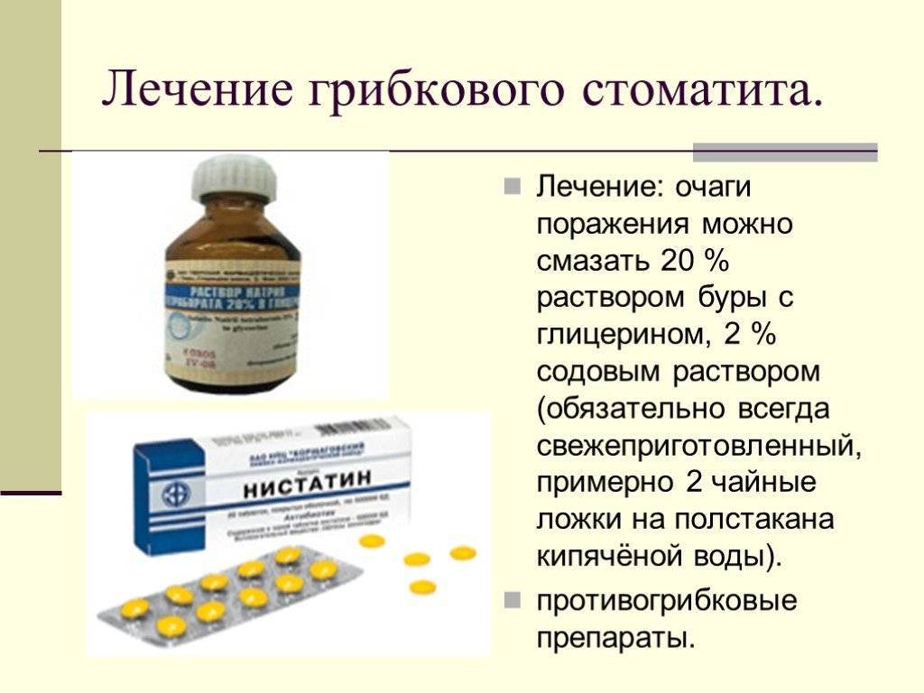 Во рту мазать. От стоматита во рту у взрослых лекарство недорогое эффективное. Средства от стоматита во рту у взрослых сильнодействующее. От стоматита во рту у детей лекарство. Лекарство от стоматита во рту у детей 10 лет.